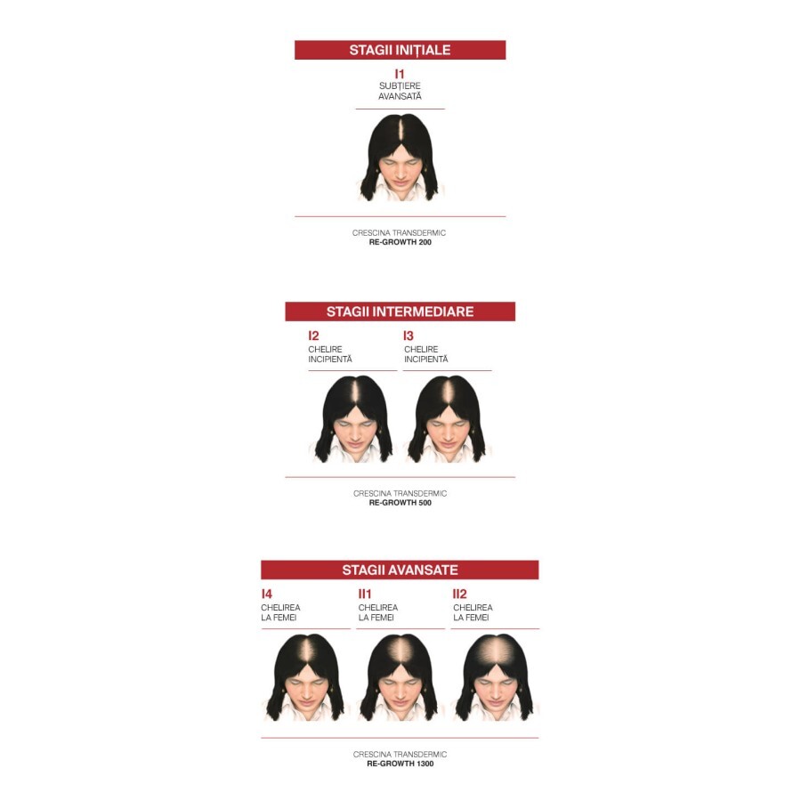 Tratament complet pentru stadii inițiale de cădere și rărire a părului la femei Crescina Follicular Islands 1700, 10 + 10 fiole, Labo