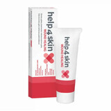 Help4Skin Wound Healing, gel hidrocoloid, 20 g