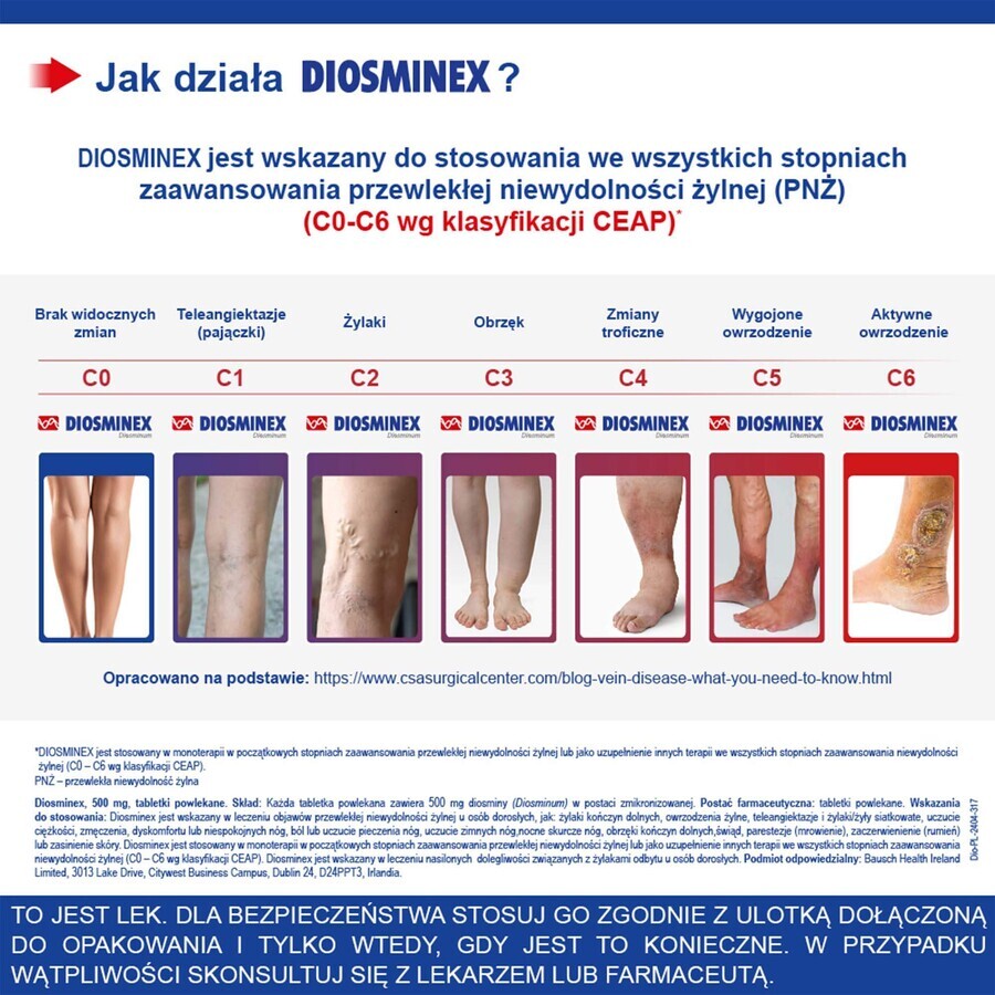 Diosminex 500 mg, 60 compresse