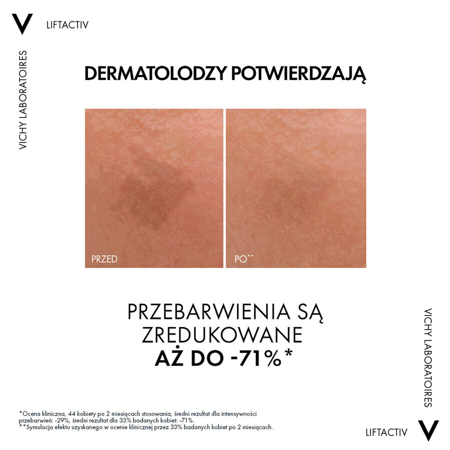 Vichy Liftactiv Specialist B3, ser pentru reducerea decolorării și a ridurilor, 30 ml