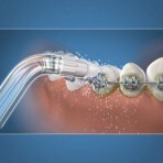 Capete ortodontice pentru dușul bucal, 2 bucăți, OD-100, Waterpik